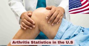 Arthritis Statistics in the U.S. 2025 | Types & Causes