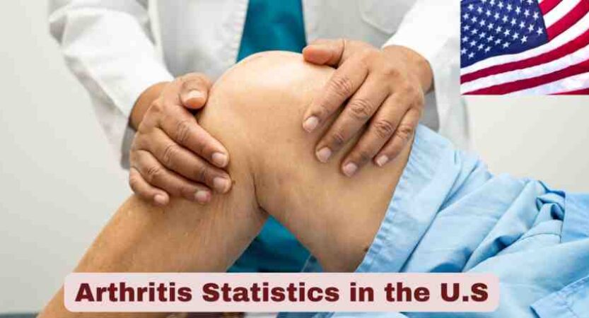 Arthritis Statistics in the U.S. 2025 | Types & Causes