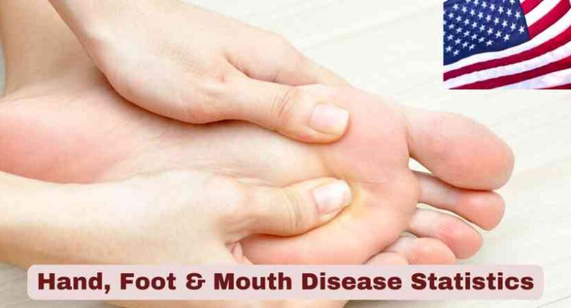 Hand, Foot & Mouth Disease in US 2025 | Stats & Facts about HFMD