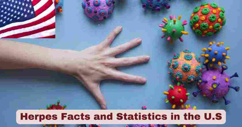 Herpes Facts and Statistics in the U.S. 2025