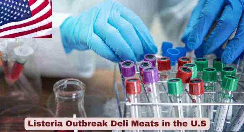 Listeria Outbreak Deli Meats Statistics in the U.S. 2025 | Key Facts