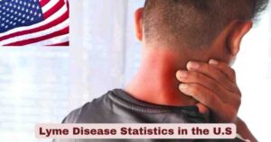 Lyme Disease Statistics in the U.S. 2025 | Facts about Lyme