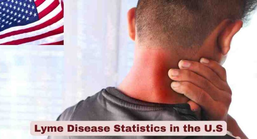 Lyme Disease Statistics in the U.S. 2025 | Facts about Lyme