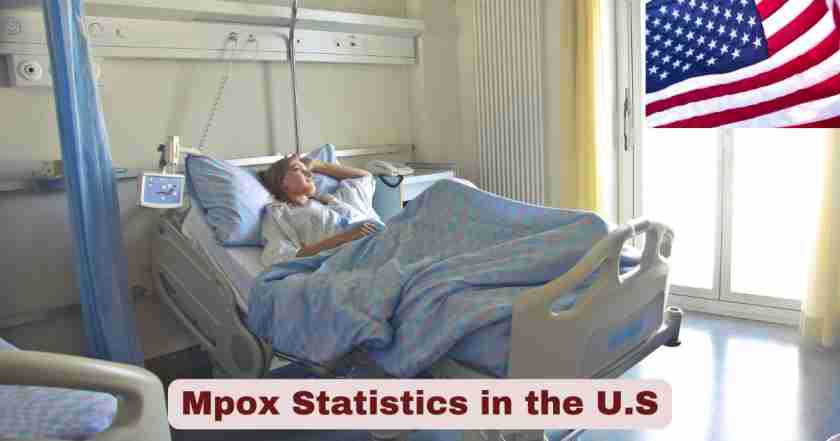 Mpox Statistics in the U.S. 2025 | Monkeypox Facts