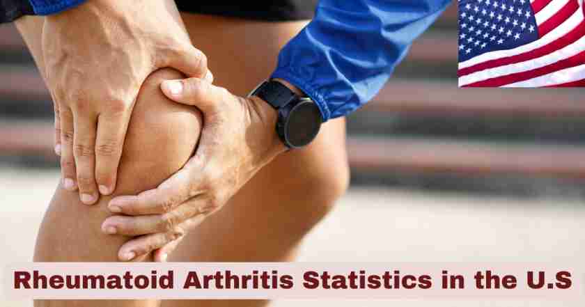 Rheumatoid Arthritis Statistics in the U.S. 2025 | Key Facts