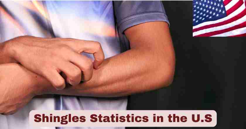 Shingles Statistics in the U.S. 2025 | Shingles Facts