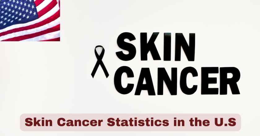 Skin Cancer Statistics in the U.S. 2025 | Skin Cancer Facts