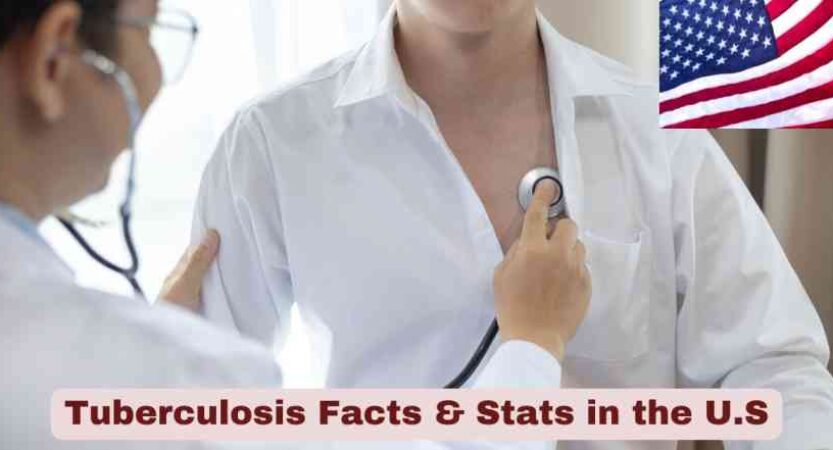 Tuberculosis Facts in the U.S. 2025 | TB Stats