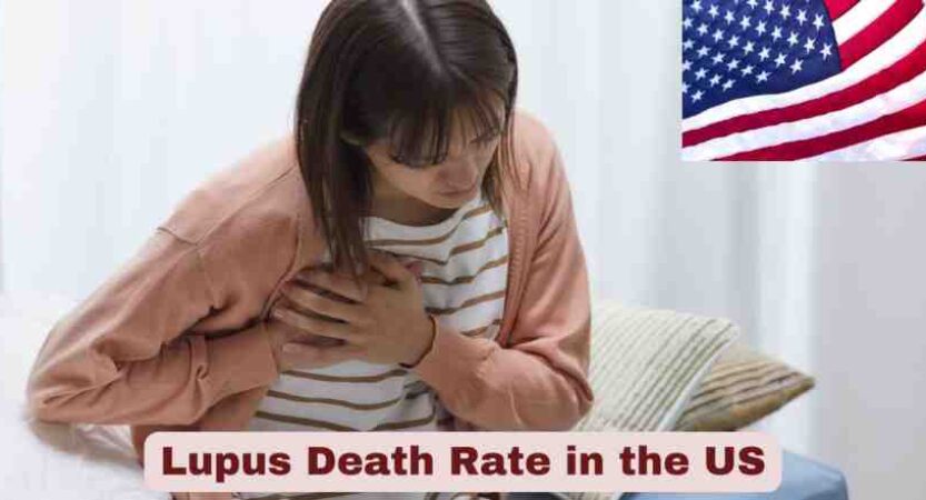 Lupus Death Rate in the US 2025 | Statistics & Facts