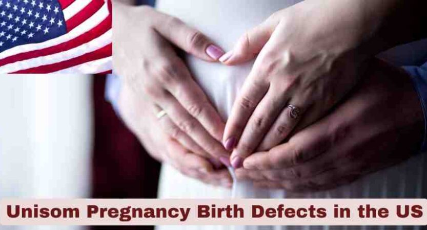 Unisom Pregnancy Birth Defects in US 2025 | Statistics & Facts