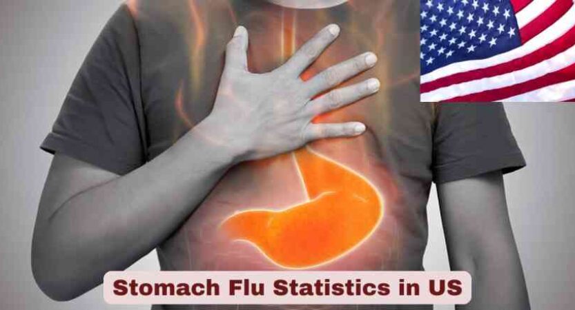 Stomach Flu Statistics in US 2025 | Treatments