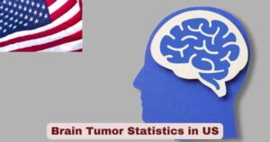 Brain Tumor Statistics in US 2025 | Key Facts