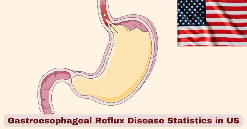 Gastroesophageal Reflux Disease Statistics in US 2025 | Key Facts