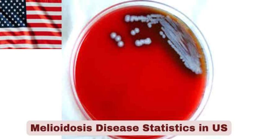 Melioidosis Disease Statistics in US 2025 | Key Facts