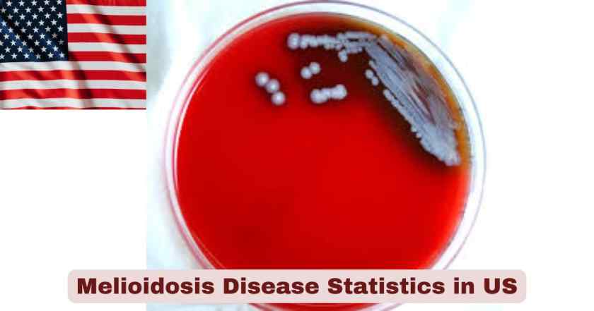 Melioidosis Disease Statistics in US 2025 | Key Facts