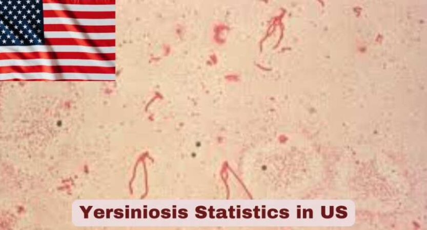 Yersiniosis Statistics in US 2025 | Key Facts