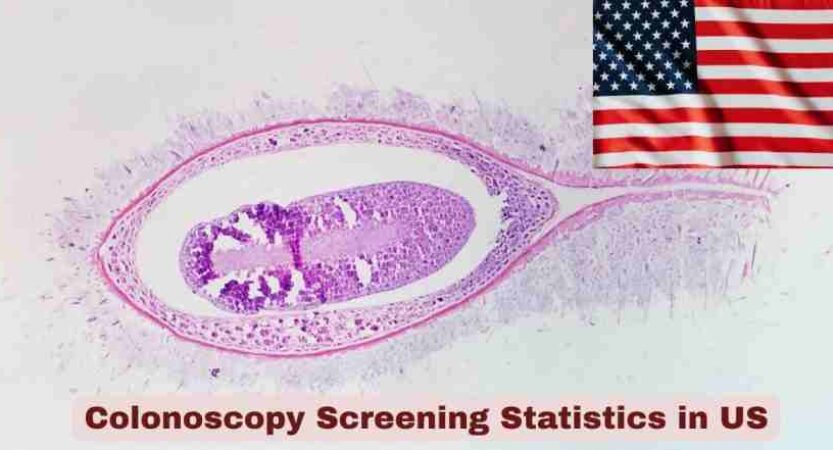 Colonoscopy Screening Statistics in US 2026 | Key Facts
