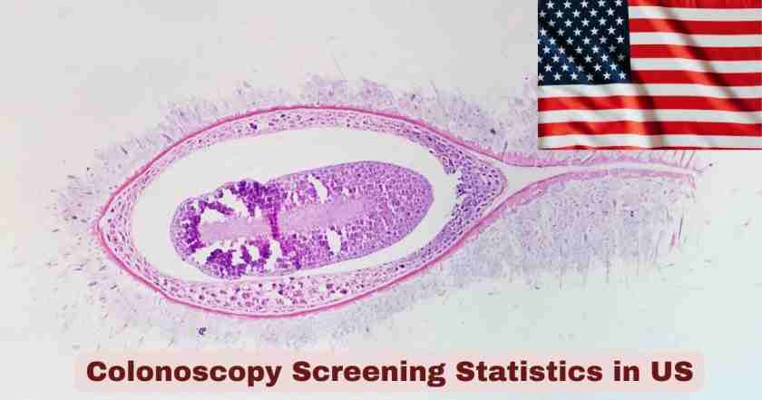 Colonoscopy Screening Statistics in US 2026 | Key Facts