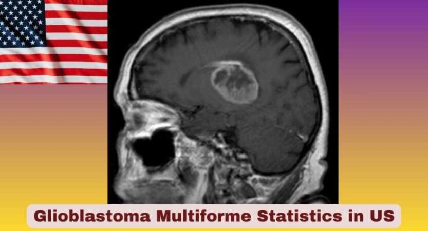Glioblastoma Multiforme Statistics in US 2026 | Key Facts