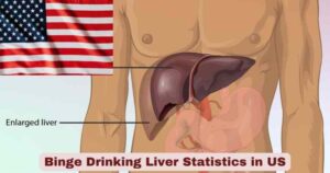 Binge Drinking Liver Statistics in US 2026 | Symptoms & Treatments