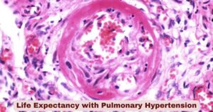 Life Expectancy with Pulmonary Hypertension 2026 | Key Facts