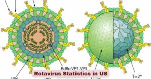 Rotavirus Statistics in US 2026 | Symptoms & Vaccination