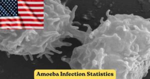 Amoeba Infection Statistics 2026 | Water Systems, Cases & Facts