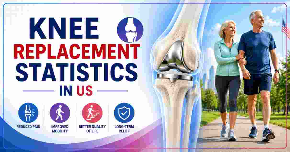 Knee Replacement Statistics in US 2026 | Recovery, Costs & Key Facts