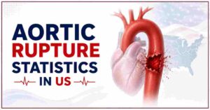 Aortic Rupture Statistics in US 2026 | Symptoms, Treatments & Facts