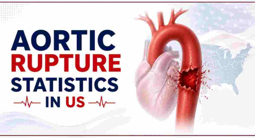 Aortic Rupture Statistics in US 2026 | Symptoms, Treatments & Facts